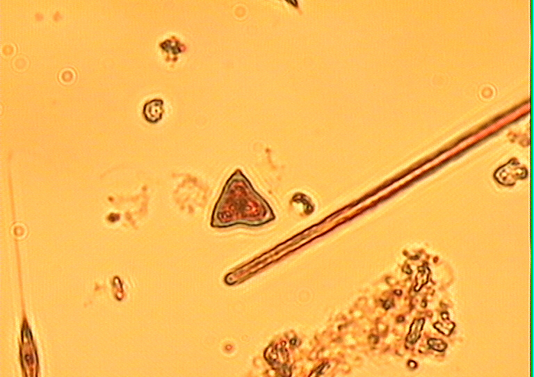 Dictyocha speculum